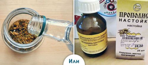 Чим полоскати горло при ларингіті фарингіті