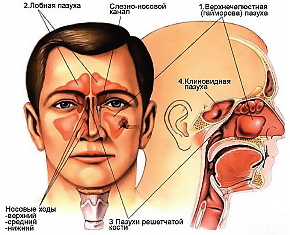 Чим відрізняється риніт від синуситу