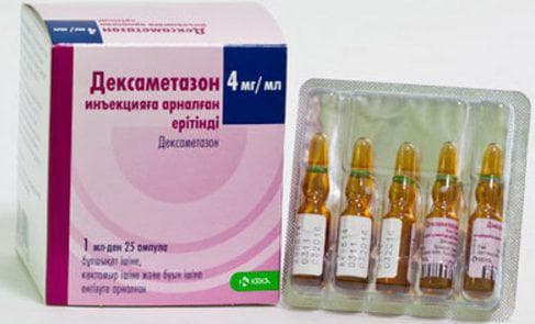 Чим і як лікувати запалення носоглотки