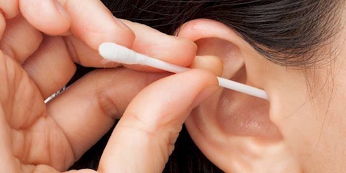 Чистити вуха перекисом. Як лікувати отит вуха перекисом водню