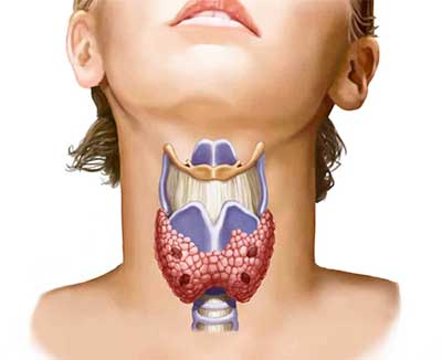 Чому болять прищі