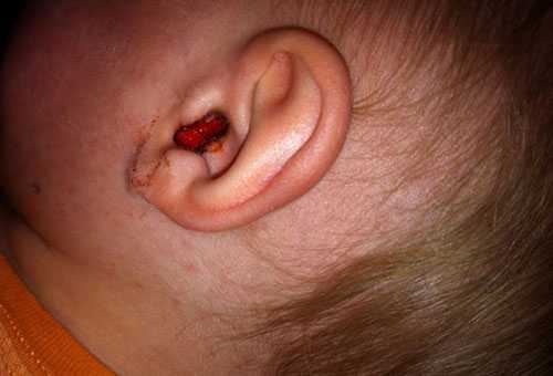 Чому дитина чухає вухо