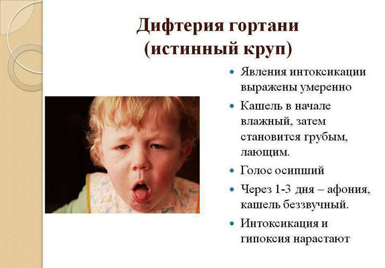 Чому дитина хрипить? Причини і можливі захворювання. Що робити, якщо дитина хрипить