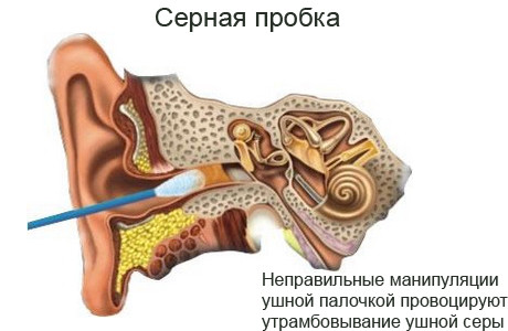 Чому глохне одне вухо і як це лікувати
