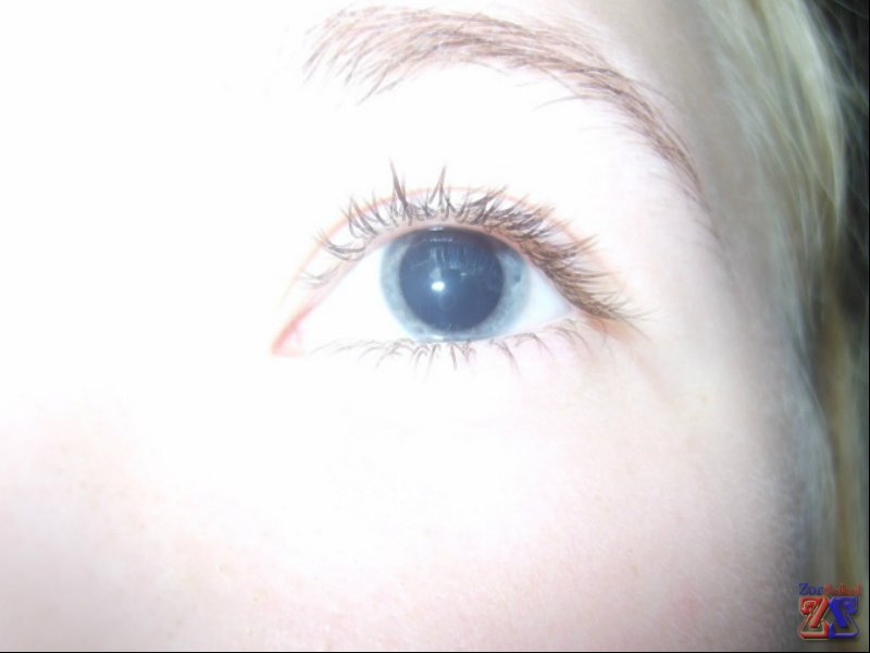 Чому небезпечно закапувати очні краплі Цикломед в ніс