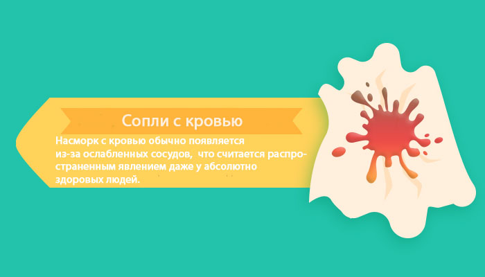 Чому у дорослих і дітей виходять соплі з кров’ю