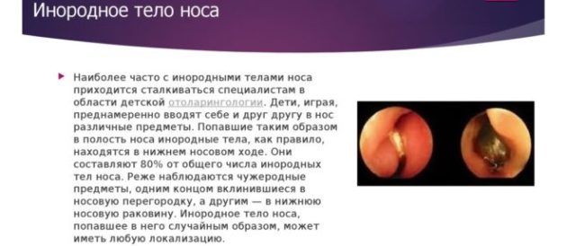 Чому в положенні лежачи закладає ніс і що робити? Чому закладає ніс у положенні лежачи? Причини і лікування.
