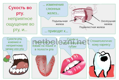 Чому в’язка слина і сушить у роті, причини якої хвороби?