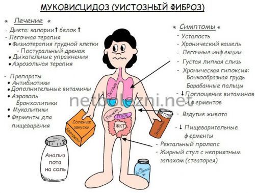 Чому в’язка слина і сушить у роті, причини якої хвороби?