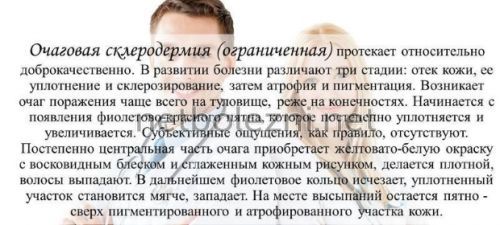 Чому в’язка слина і сушить у роті, причини якої хвороби?