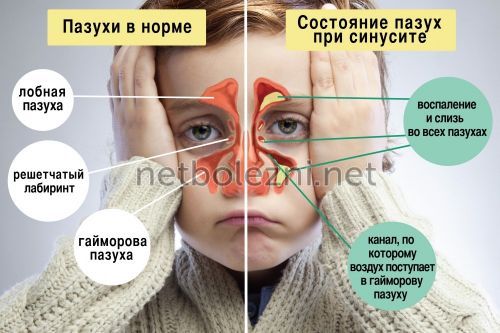 Чому в’язка слина і сушить у роті, причини якої хвороби?