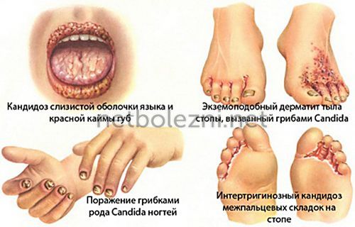 Чому в’язка слина і сушить у роті, причини якої хвороби?