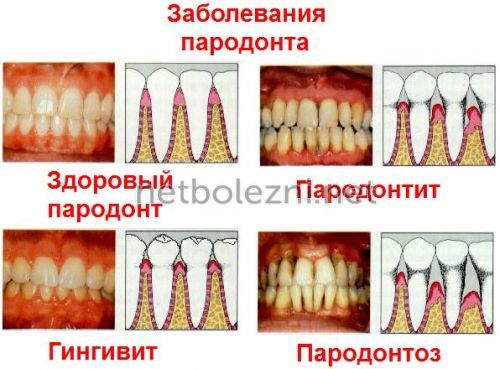 Чому в’язка слина і сушить у роті, причини якої хвороби?