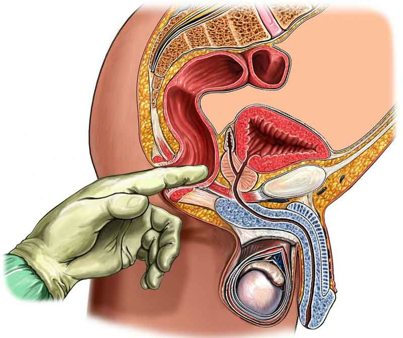 Чому виникає часте сечовипускання у чоловіків вночі