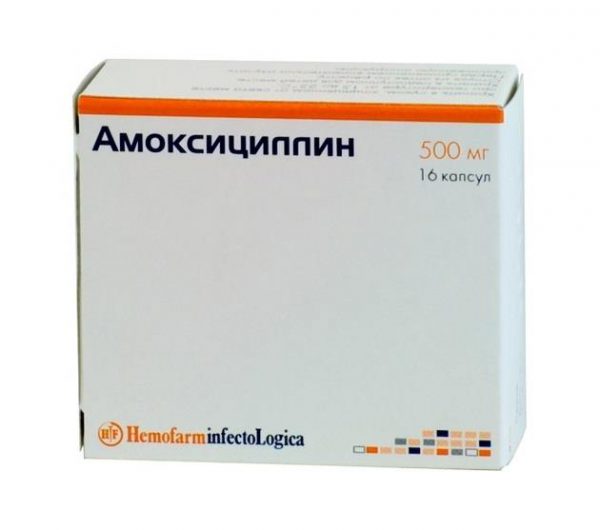 Чому виникає кашель з зеленої мокротою і як його правильно лікувати