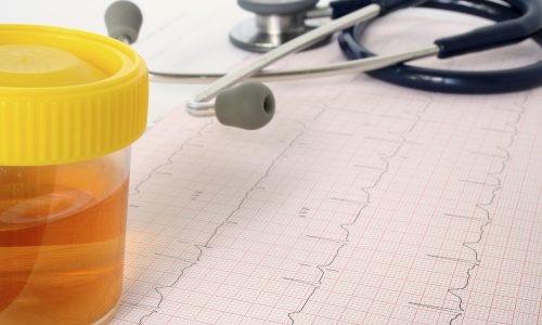 Чому виникає свербіння в сечовипускальному каналі