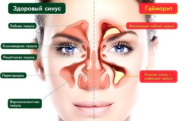 Чому виникають помаранчеві соплі і як від них позбавитися