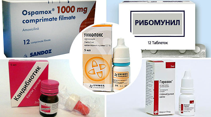 Чому з вуха тече жовта, прозора, коричнева рідина, гній? З вуха виділяється гній, рідина: лікування аптечними препаратами. Краплі і антибіотики для лікування виділень з вух: список Чому з вуха тече жовта, прозора, коричнева рідина, гній? З вуха виділяється гній, рідина: лікування аптечними препаратами. Краплі і антибіотики для лікування виділень з вух: список