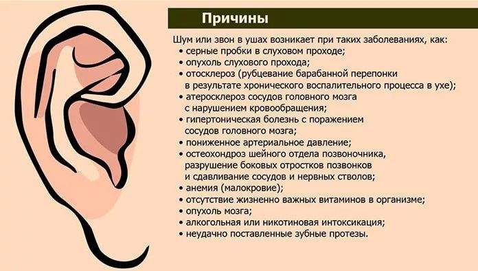 Чому з’являється тріск у вусі і як від нього позбавитися? Чому у вухах виникає тріск і що з цим робити.