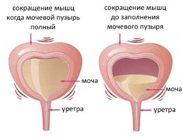 Чому з’являється відчуття повного сечового міхура після сечовипускання у чоловіків і жінок