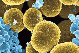 Чому з’являється золотистий стафілокок у вусі і як його лікувати. Стафілокок у вухах: симптоми та особливості лікування