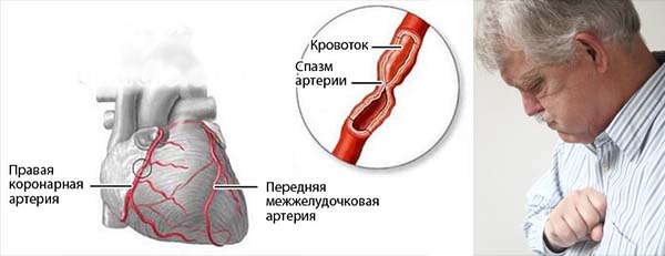 Чому запалюються лімфовузли за вухами: причини та діагностика. Способи лікування та профілактики запалення лімфовузлів за вухами – Автор Катерина Данилова