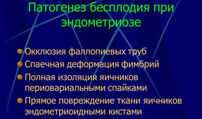 Чотири стадії ретроцервикального ендометріозу