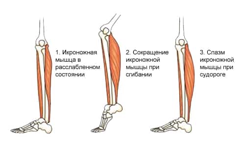 Цифран: інструкція із застосування антибіотика для дорослих і дітей, аналоги