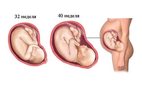 Цифран: інструкція із застосування антибіотика для дорослих і дітей, аналоги