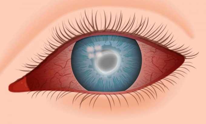 Цифран (СТ, ОД): інструкція по застосуванню, ціна та відгуки
