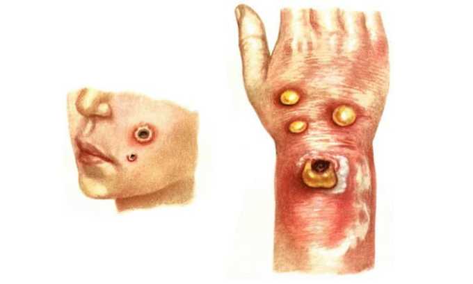 Цифран (СТ, ОД): інструкція по застосуванню, ціна та відгуки