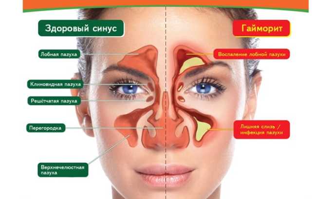 Цифран (СТ, ОД): інструкція по застосуванню, ціна та відгуки