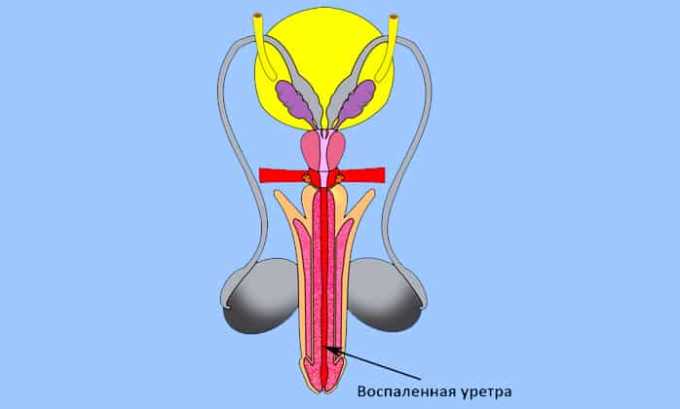 Цифран (СТ, ОД): інструкція по застосуванню, ціна та відгуки