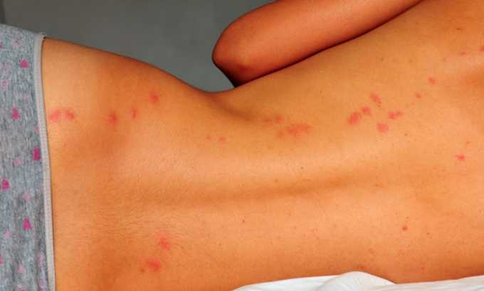 Цифран (СТ, ОД): інструкція по застосуванню, ціна та відгуки