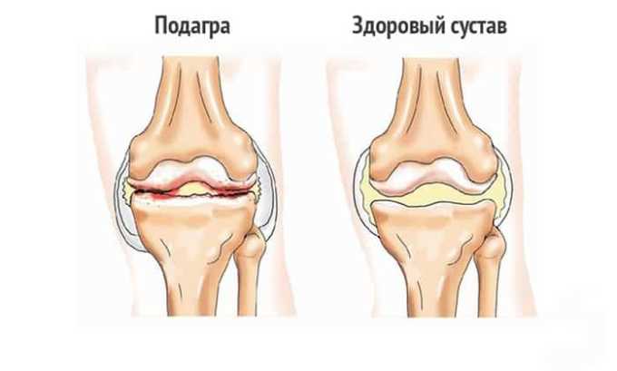 Цистон сечогінний чи ні ЛечимПочку