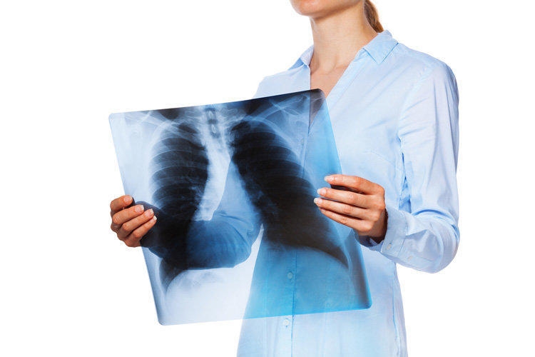 Діагностика і лікування туберкульозу – Перший з туберкульозу