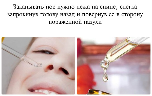 Діоксидин краплі у вуха дозування і правила застосування