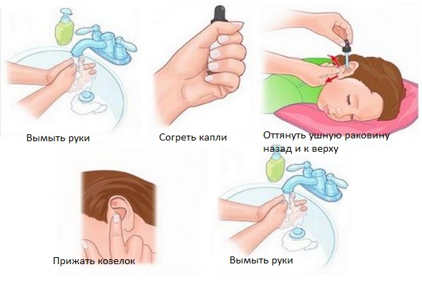 Діоксидин краплі у вуха дозування і правила застосування