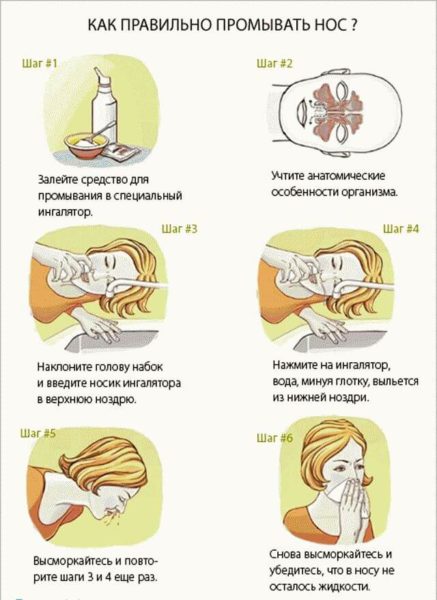 Діоксидин в ніс дорослому дозування при гаймориті