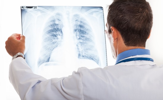 Де і як часто можна робити рентген легенів дитині