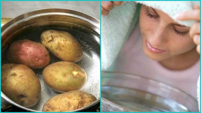 Дихати над картоплею при нежиті та гаймориті: Чи можна і як правильно