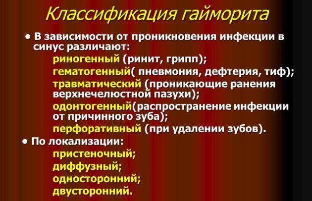 Для чого необхідний рентген гайморових пазух і як виглядає гайморит на знімку