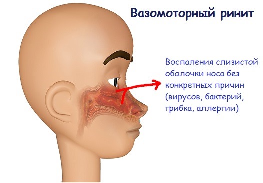 Для чого потрібно кварцування горла і носа