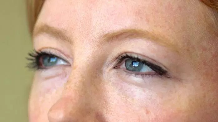 Догляд за шкірою навколо очей – ефективні методики і засоби повернуть красу