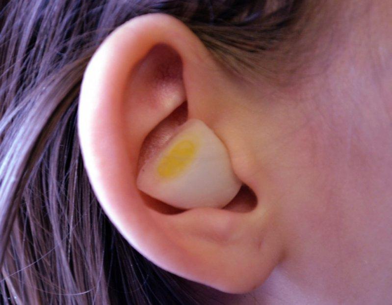 Допомагає часник у вуха від нежиті? Часник у вуха