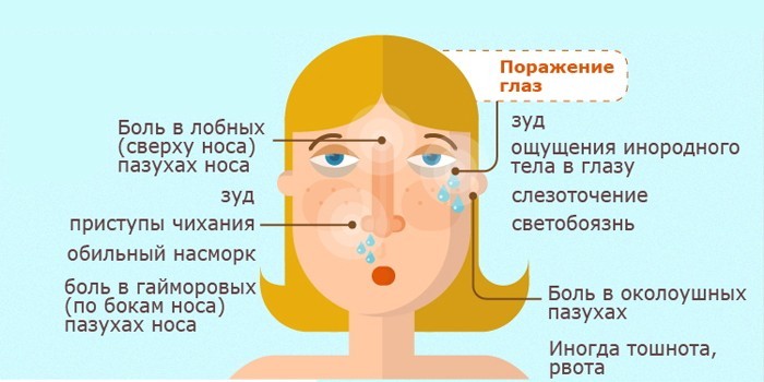 Двосторонній гайморит методи лікування