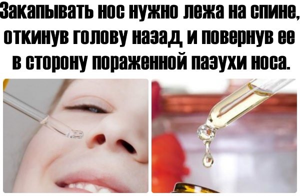 Ефективний засіб від нежитю для дітей. Лікування нежиті у дітей