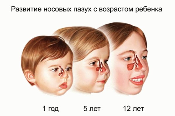 Ефективний засіб від нежитю для дітей. Лікування нежиті у дітей