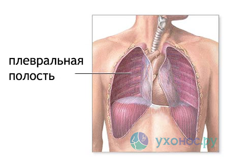 Ексудативний (випотной) плеврит: особливості, ознаки, лікування