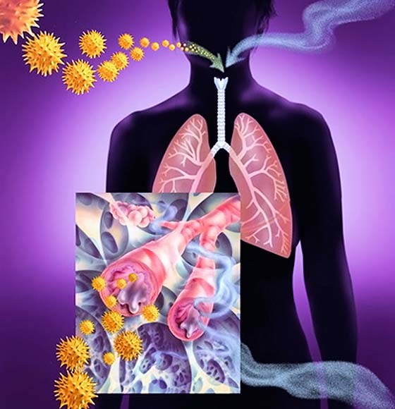 Емфізема легенів не вирок збільшуємо тривалість життя